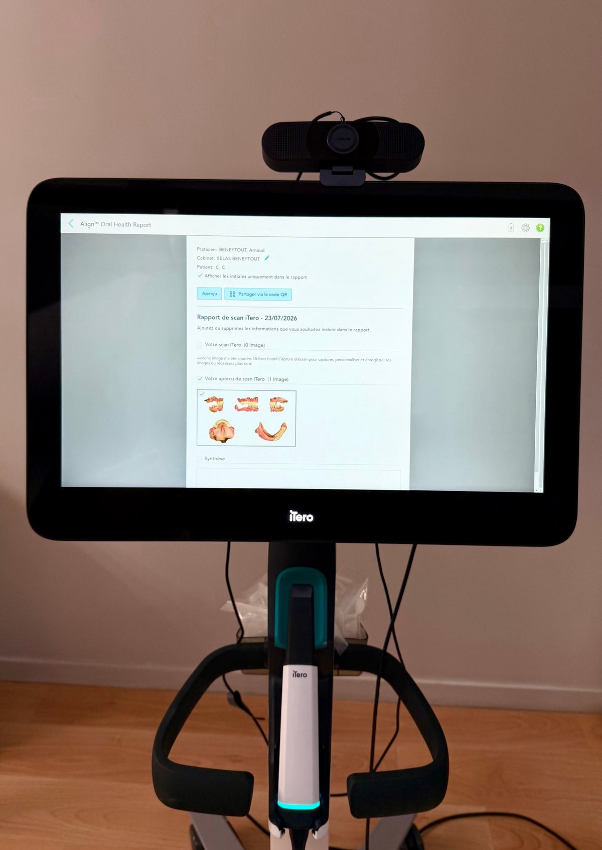 Caméra numérique iTero du cabinet : aperçu du scan 3D des arcades à l'écran
